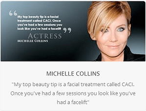 michelle-collins caci facial treatment